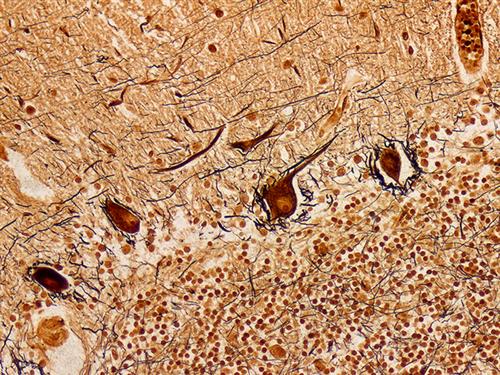 4058A | Control Slides:Histopathology; Bielschowsky